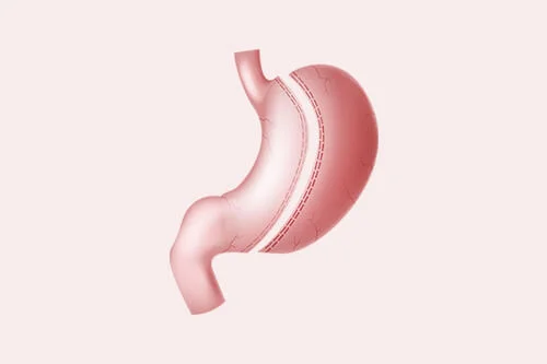 Safe Surgery